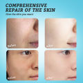 RtopR Vitamin C Serum Snail Brightening Fade Dark Spot Lightening Serum Brightening Skin Care Fine Lines Anti-aging Whiten Moisturize Less Breakouts Facial Serum Skincare for Men and Women 20ml. 