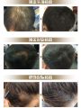 Hair fiber powder hair enlargement men and women hair patch hairline powder filler spray infill hair to cover baldness and thinning. 
