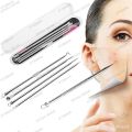 4 Pieces Acne Extractor Tool Kit – Safe Blackhead, Whitehead & Pimple Removal Set. 