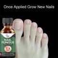 100% Original Nail Fungus Treatment Stop Fungal Growth Effective Fingernail 10ml. 