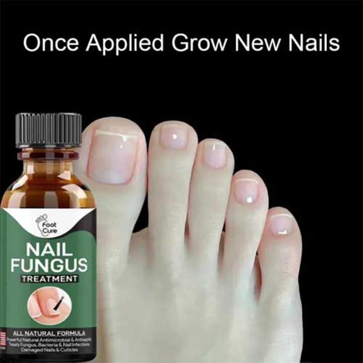 100% Original Nail Fungus Treatment Stop Fungal Growth Effective Fingernail 10ml