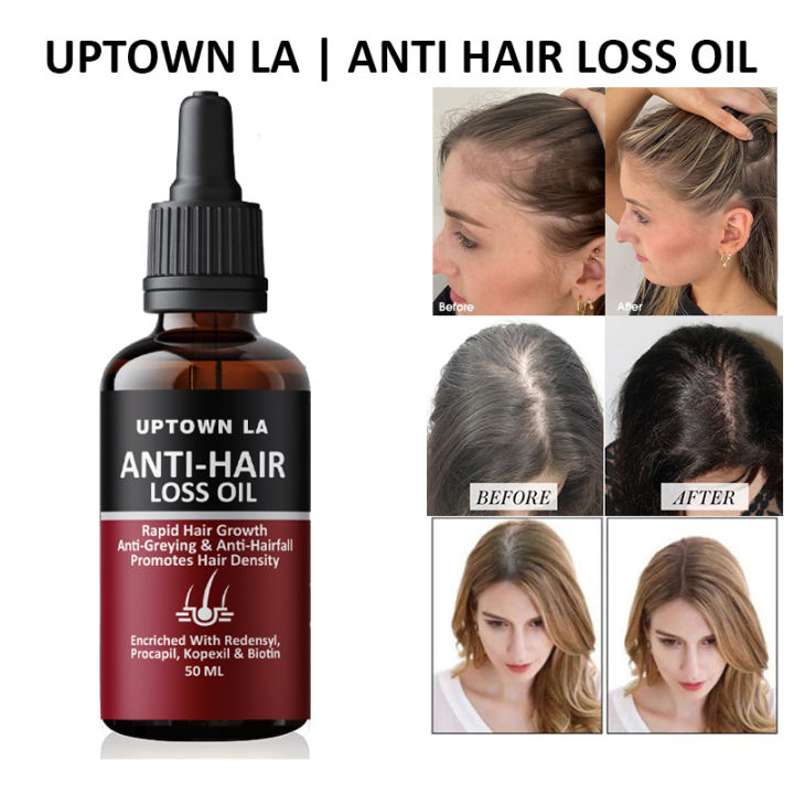 Uptown%20LA%20Anti%20Hair%20Loss%20Hair%20Regrowth%20Oil%20%2030%20ml%20-%20Image%207