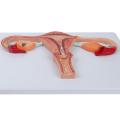 Human Fertilization Process Model, Features Cross-Section of Uterus, Ovaries, and Fallopian Tubes with Gametes | Embryology Teaching Model. 