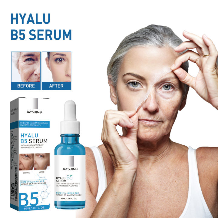 Jaysuing: Anti-wrinkle & Firming B5 Serum lightens fine lines, moisturizes, lifts, brightens the face and firms the skin