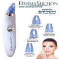 Derma Suction Blackhead Removal Machine 4 in 1 Black Head Remover Machine - Acne Pore Cleaner Vacuum Suction Tool Blackhead Removal On Nose Sucking Machine. 