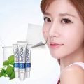 Bio aqua Acne Cream Face Skin Care Acne Anti-Wrinkle Removal Cream Spots Scar Blemish Marks 30g. 