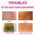 Hip Acne Treatment Cream Butt Inner Thigh Pimples Clearing Remove Dark Spot Prevent Buttock Pores Clogging Body Acne Repair Care. 