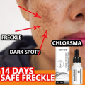 Niacinamide Dark Spot Remove Serum Anti-aging Bright Freckle Whiten Skin Cream Fade Pigmentation Melasma Moisture Face Skin Care. 