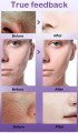UPTOWN LA PORE REFINING Serum with lactobionic acid and Niacinamide For shrinking pores For all skin types 30 ML. 