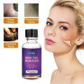 10ml/20ml/30ml/50ml Skin Tag Remover For Common And Plantar Warts Remove. 