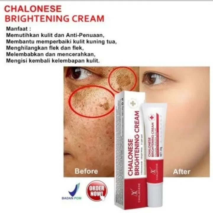 Chalonese%20Brightening%20Cream%20Brightening%20cream%20-%20Image%206