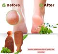 PUMICE STONE FOOT SCRUBBER Callus Remover Exfoliating Clay Stone for Feet Hands Body Care Natural Foot File Heel Scraper Skin Care Pedicure Tool for Cracked Heels & Dead Skin. One side remove dead skin, other side polishes and smoothens your skin.. 