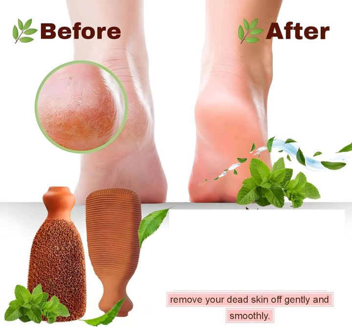 PUMICE%20STONE%20FOOT%20SCRUBBER%20Callus%20Remover%20Exfoliating%20Clay%20Stone%20for%20Feet%20Hands%20Body%20Care%20Natural%20Foot%20File%20Heel%20Scraper%20Skin%20Care%20Pedicure%20Tool%20for%20Cracked%20Heels%20&%20Dead%20Skin.%20One%20side%20remove%20dead%20skin,%20other%20side%20polishes%20and%20smoothens%20your%20skin.%20-%20Image%208