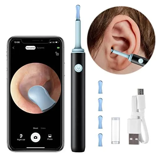 Smart%20Visual%20Ear%20Wax%20Cleaning%20Kit%20with%20Camera%20HD%20%E2%80%93%20Wireless%20Ear%20Cleaner%20Endoscope%20%E2%80%93%20Rechargeable%20Earwax%20Removal%20Tool%20with%20Soft%20Silicone%20Tips%20-%20Rechargeable%20HD%20Ear%20Camera%20with%20Mobile%20Display%20-%20Image%203
