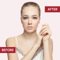 Face Fresh Whitening Soap Oily Skin (100gm). 