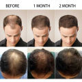 Refill Caboki Hair Building Fibers 25 Grams All Colors Available Caboki Dark Brown, Refill Bag Caboki Black, Refill Caboki Medium Brown, Refill Caboki Light Brown Caboki Hair Building Fibers, Fill In Fine or Thinning Hair Instantly Thicker Men & Women. 
