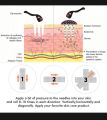 Derma roller 0.5mm with 540 Micro Needles - Derma Roller for Hair Growth - Derma Roller for Skin - Derma Roller for Face - Derma Roller for Hair. 