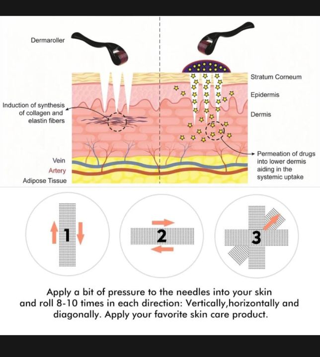 Derma%20Roller%200.5mm%20with%20540%20Micro%20Needle%20for%20Hair%20Growth%20and%20Facial%20Skin%20Therapy%7C%20Skin%20Care%20Beauty%20Tool%20for%20Anti-Aging%20Skin%20Repair,%20Anti%20Wrinkles%20Stretch,%20and%20Acne%20Scars%20Removal%20for%20Men%20and%20Women%20-%20Image%206