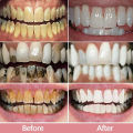 Teeth Whitening Toothpaste Fast Remove Smoke Coffee Tea Stains Cleaning Oral Hygiene Plaque Fresh Breath Bleaching Dental Tools. 