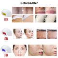 27 Lac Flashes Permanent laser Hair Removal machine, IPL Epilator,  Skin Rejuvenation, Freckle Reduce ,Hair Removal Appliances  New Upgraed Model. 