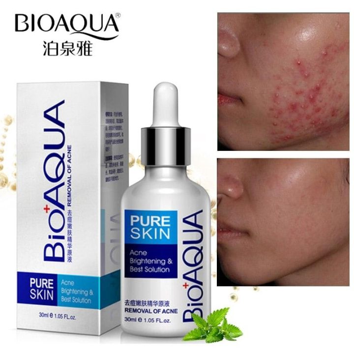 BioAqua%20Pure%20Skin%20Anti%20Acne%20Serum%20Facial%20Removal%20Solution%2030ml%20-%20Image%204