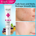 RtopR Scar Removal Cream Acne Scar Treatment Face Face Cream Repair Skin Care Stretch Burn Scar Remover Skin Repair Spots Body Skin Cream 15g. 
