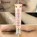 Non-greasy Scar Remover Quick Results Yoxier Scar Reduction Scar Cream Natural Regenerating Skin Rejuvenation Smooth Skin Safe. 