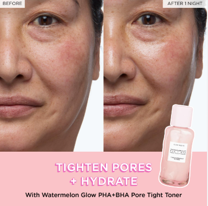 Glow%20Recipe%20Watermelon%20Glow%20PHA%20+%20BHA%20Pore-Tight%20Toner%20150ml%20-%2011.11%20Big%20Sale%20Discount%20%E2%80%93%20Hydrating%20&%20Exfoliating%20Toner%20for%20Smooth,%20Radiant%20Skin%20-%20Image%204