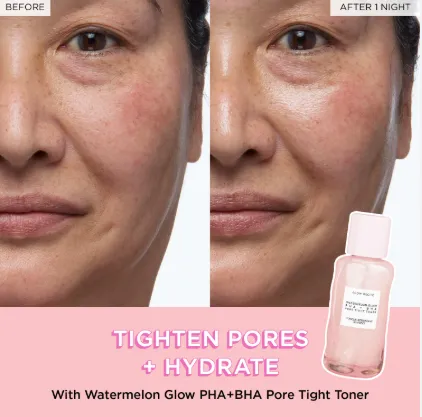 Glow%20Recipe%20Watermelon%20Glow%20PHA%20+%20BHA%20Pore-Tight%20Toner%20150ml%20-%2011.11%20Big%20Sale%20Discount%20%E2%80%93%20Hydrating%20&%20Exfoliating%20Toner%20for%20Smooth,%20Radiant%20Skin%20-%20Image%204