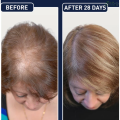 phone case FEG Organic Anti Hair Loss Hair Growth Treatment Oil For Thicker Long Hair  50ML. 
