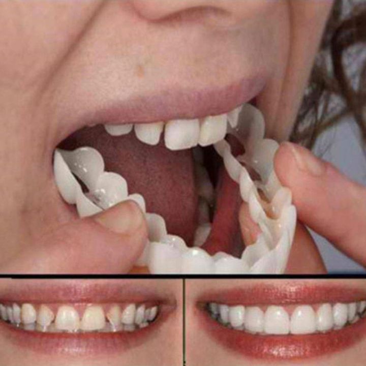Snap-On Smile Silicone Imitation Braces – Safe & Comfortable Artificial Teeth Decoration Kit | Best Quality & Natural Look
