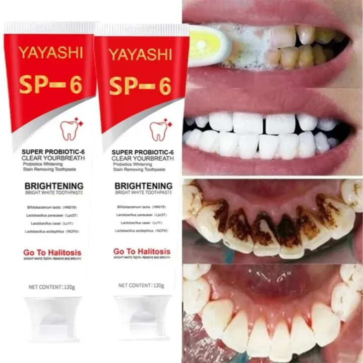 SP 6 Ultra Whitening SP 6 Toothpaste Ultra Whitening Toothpaste SP- 6 ...