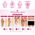 Whitening Cream. 