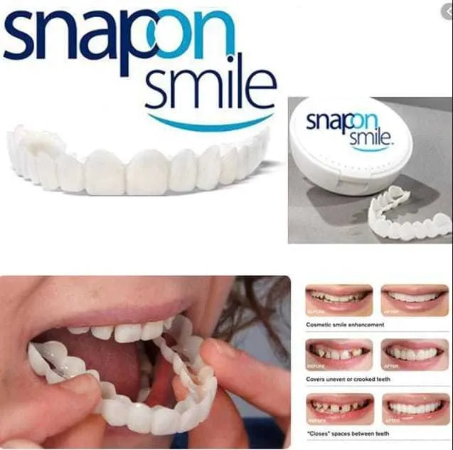 Invisible Snap-On Veneer Aligner – Natural White Smile Cover & Teeth ...