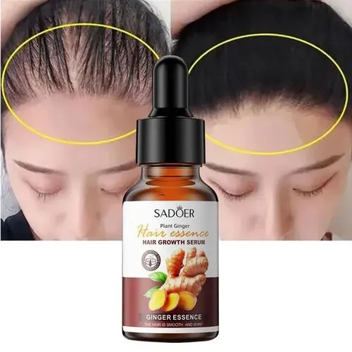 Hair%20Growth%20Serum%20%E2%80%93%20Anti%20Hair%20Fall%20%E2%80%A2%20Faster%20Hair%20Regrowth%20%E2%80%A2%20Strengthens%20Roots%20%E2%80%A2%20Thick,%20Healthy%20&%20Volumized%20Hair%20%E2%80%93%20Herbal%20Extract%20Formula%20%E2%80%93%2030ml%20-%20Image%207