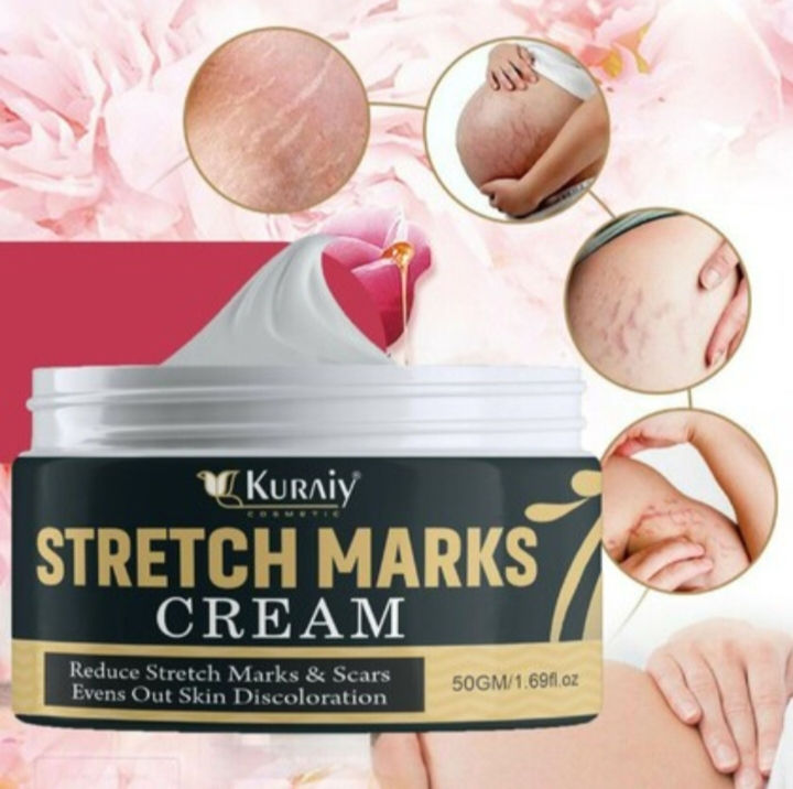 Pregnancy Stretch marks removal cream for Women, during after pregnancy ALL TYPE SKIN STRETCH (30 ml)