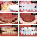 Teeth Whitening Toothpaste Fast Remove Smoke Coffee Tea Stains Cleaning Oral Hygiene Plaque Fresh Breath Bleaching Dental Tools. 