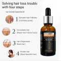 Pei Mei Hair Growth Essential Oil – Anti Hair Fall, Fast Hair Regrowth, Strengthening & Nourishing Scalp Treatment Serum for Men & Women. 