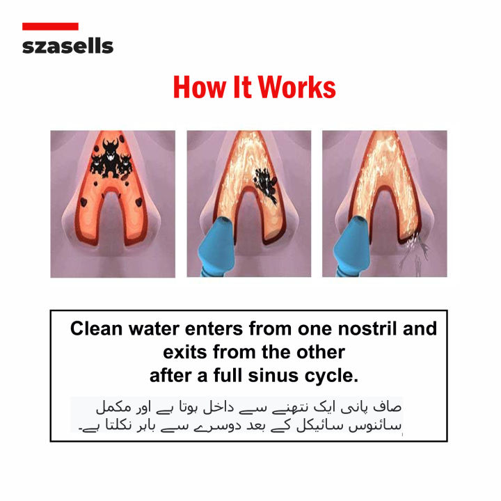300ml%20Nasal%20Rinse%20Wash%20Push%20Button%20Self%20Draining%20Neti%20Pot%20For%20Congestion%20Sneezing%20Pollution%20Flu%20Cold%20Smog%20Dry%20Passage%20and%20Allergy%20With%20Two%20Color%20Options%20of%20Blue%20and%20Purple%20Waterpulse%20NetiPot%20by%20SZASELLS%20-%20Image%205