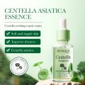 Bioaqua Centella Asiatica Soothing Repair Anti Acne Face Serum Essence 30ml. 