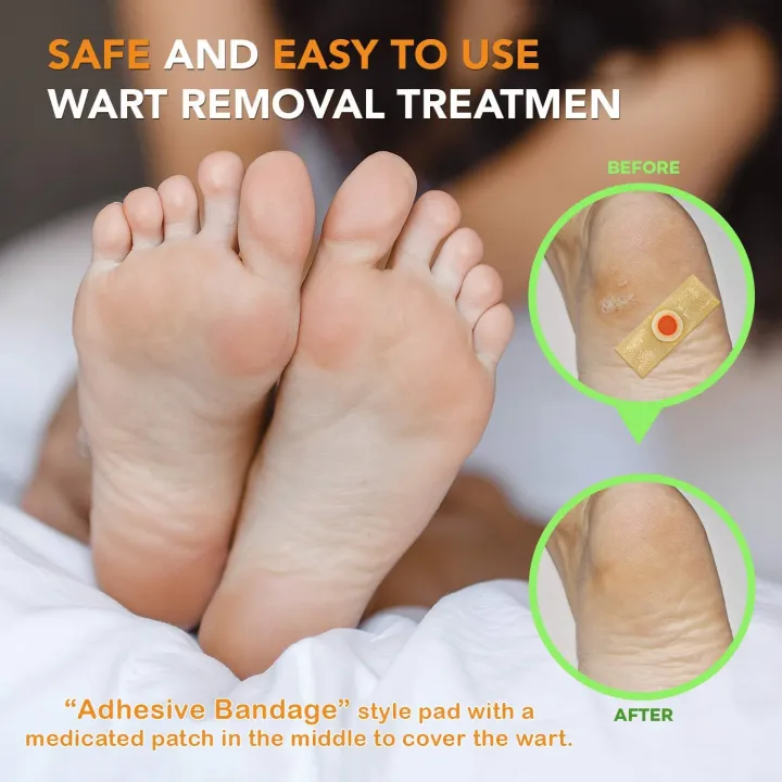 Wart%20Remover,%20Corn%20Cap%20Wart%20Removal%20Plasters%20Pad,%20Foot%20Corn%20Removal%20Plaster%20with%20Hole,%20Feet%20Callus%20Remove,%20Soften%20Skin%20Cutin%20Sticker%20Cure%20Toe%20Protector,%20Relief%20Pain%20Removal%20Warts%20Plaster%2015%20Pcs%20-%20Image%206