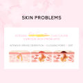 LAIKOU Sakura Peeling Off Nose Mask Tightening Pores Deep Cleansing Blackhead Removal 30g. 