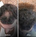 hair growth oil for men and women - Hair growth and Hair care oil - Made in Vietnam hair growth oil. 