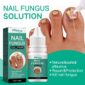 South Moon Premium Nail Fungus Treatment Serum - Effective Nail Repair & Protection for Onychomycosis. 