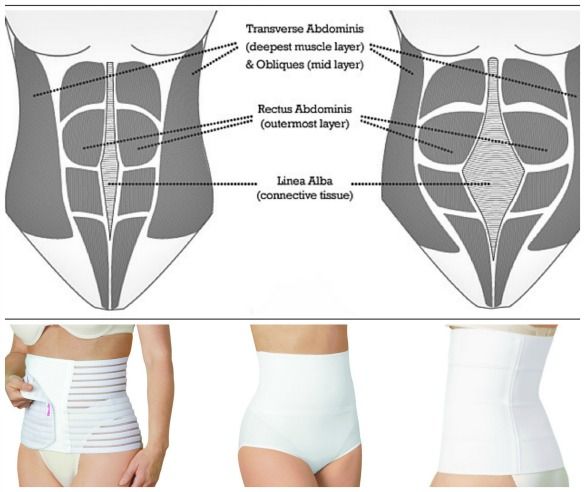 Abdominal%20Binder/%20Body%20Shaper%20for%20Postpartum%20after%20C%20section%20-%20Image%204