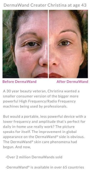 Derma%20Wand%20Anti%20Aging%20High%20Freq%20Facial%20Micro%20Pen%20Laser%20-%20Image%208