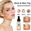20ML Face Mole Skin Serum Removal Solution Painless Mole Skin Dark Spot Removal Face Wart Tag Freckle Removal Cream Oil Plaster. 