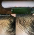 BioSeven Pro  Herbal Shampoo and Kaseer amla Oil. 