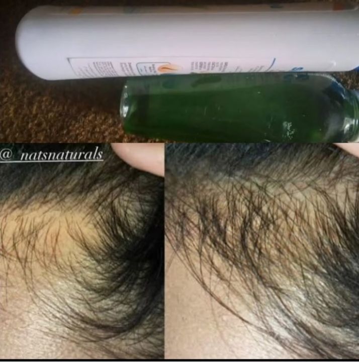 BioSeven%20Pro%20%20Herbal%20Shampoo%20and%20Kaseer%20amla%20Oil%20-%20Image%204