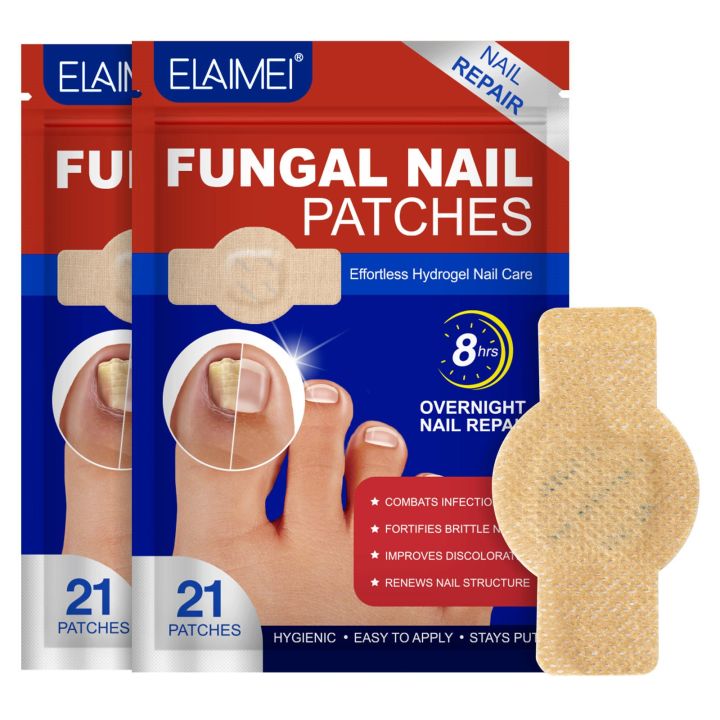1%20SOLUTION%20SHOP%20Nail%20Fungal%20Treatment%20Patch%20%7C%20Anti%20Fungus%20Toe%20Nail%20Repair%20Strips%20%7C%20Overnight%20Hydrogel%20Patch%20for%20Yellow%20Nails,%20Cracked%20&%20Brittle%20Nail%20Care%20%7C%20Fast%20Nail%20Restoration%20%7C%2021%20Patches%20%7C%20Anti%20Infection%20Nail%20Protector%20for%20Healthy%20Shiny%20Toenails%20-%20Image%202